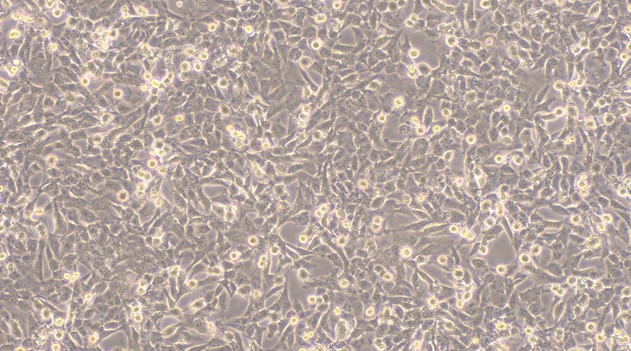 Human HS-5 Bone Marrow Stromal Cells (HS-5)