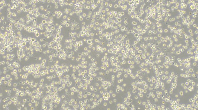 Human U266B1 Myeloma Cells (U266B1)