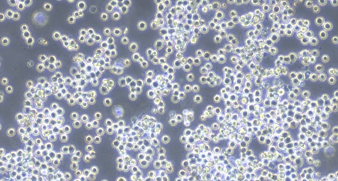 Human COLO205 Colon Carcinoma Cells (COLO205)