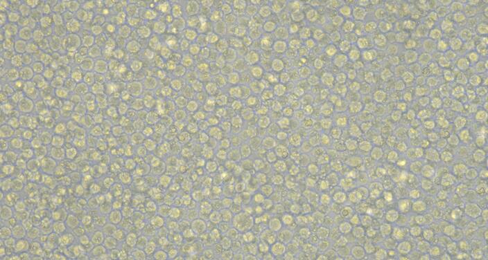 Human K-562 Chronic Myelogenous Leukemia Cells (K-562)