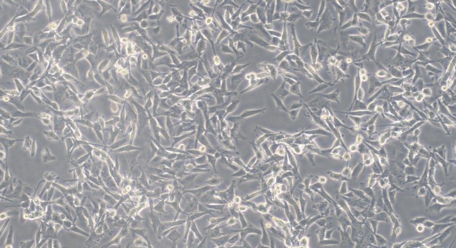 Human U-87MG Astroblastoma Cells (U-87MG)