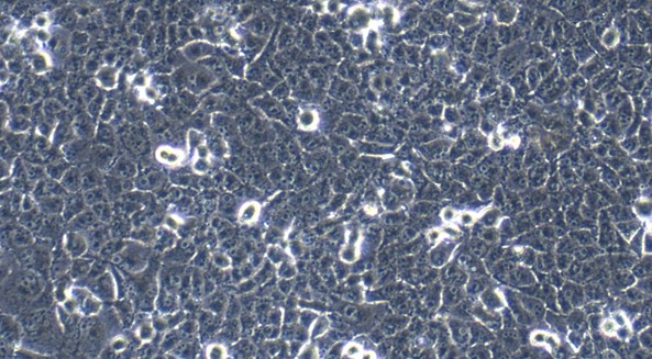 Human PANC-1 Pancreatic Cancer Cells (PANC-1)