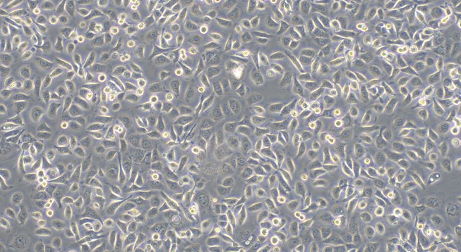 Human Nasal Epithelial Cells (NEPC)