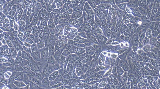 Human NCI-H460 Large-cell Lung Carcinomar Cells (NCI-H460)