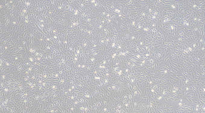 Human SK-MES-1 Lung Squamous Cell Carcinoma Cells (SK-MES-1)