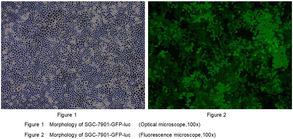 Human Luciferase SGC7901 Gastric Cancer Cells (SGC7901-Luc)