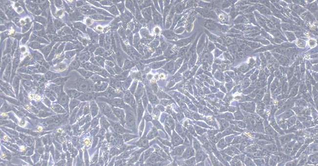 Human HGC-27 Gastric Cancer Cells (HGC-27)