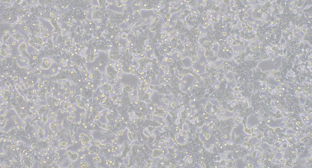 Human HT29 Colon Carcinoma Cells (HT29)
