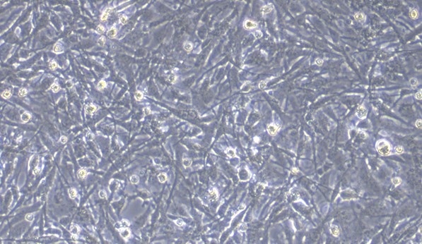 Human U251 Glioblastoma Cells (U251)