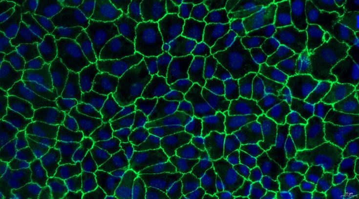 Primary Caprine Testicular Microvascular Endothelial Cells (TMEC)