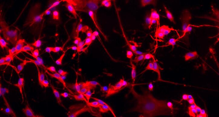Primary Rat Spinal Cord Perineurial Fibroblasts (SCPF)