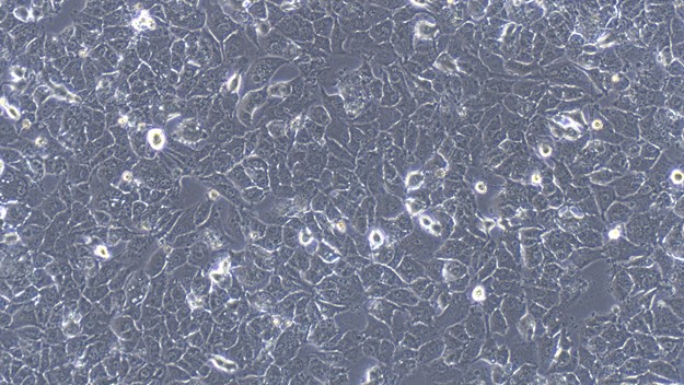 Human MHCC97-H Hepatocellular Carcinoma Cells (MHCC97-H)