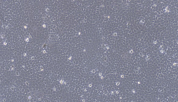 Human NCI-H292 Lung Carcinoma Cells (NCI-H292)