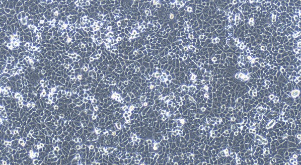 Human DLD-1 Colorectal Adenocarcinoma Epithelial cells (DLD-1 )