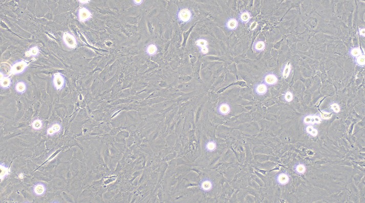 Primary Rat Nasal Mucosa Fibroblasts (NMF)