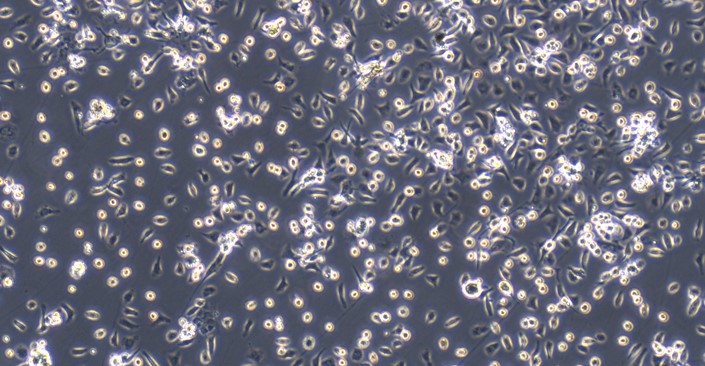 Primary Mouse Bone Marrow-Derived Macrophage Cells (BMDM)