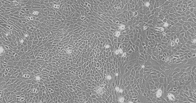 Primary Rat Olfactory Epithelial Cells (OEC)