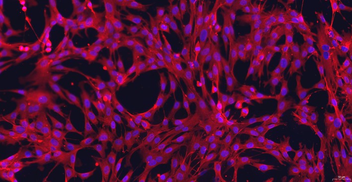 Primary Rabbit Carotid Artery Endothelial Cells (CAEC)