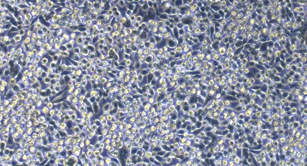 Human MKN45 Gastric Cancer Cells (MKN45)