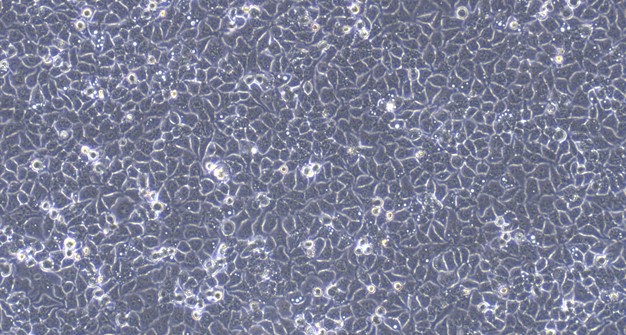 Human SACC-83 Salivary Gland Adenoid Cystic Carcinoma Cells (SACC-83)