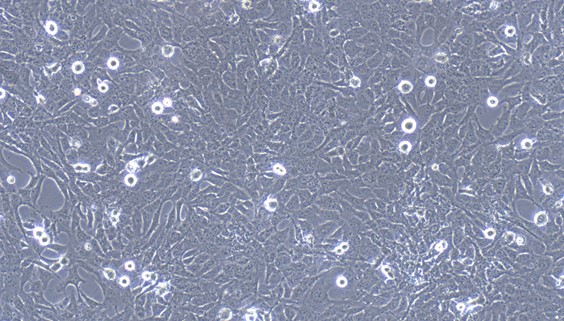 Human HTR-8/Svneo Villous Trophoblasts (HTR-8/Svneo)