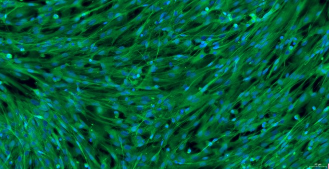 Primary Canine Trigeminal Ganglion Astrocytes (TGA)