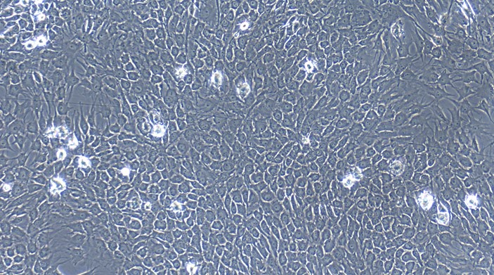 Primary Porcine Trigeminal Ganglion Astrocytes (TGA)