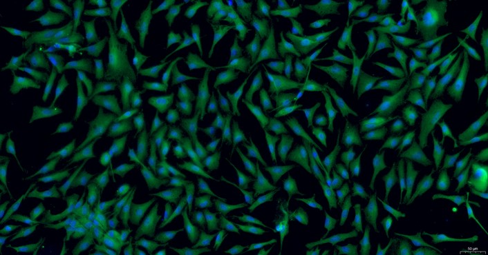 Primary Rabbit Trigeminal Ganglion Astrocytes (TGA)
