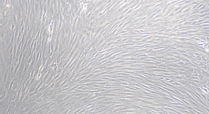 Primary Rat Cerebral Microvascular Smooth Muscle Cells ( CMSMC)