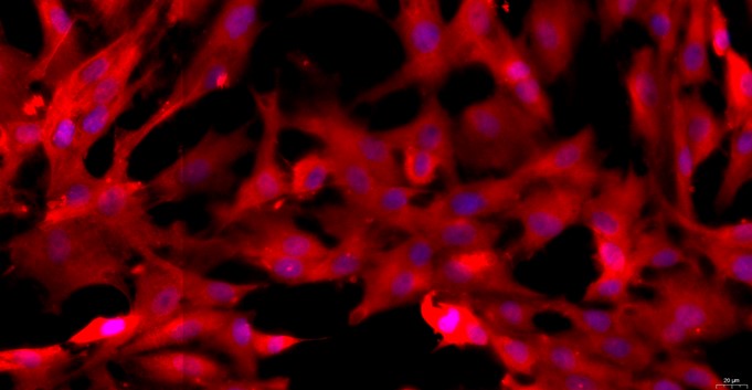Primary Rat Ovarian Interstitial Cells (OIC)