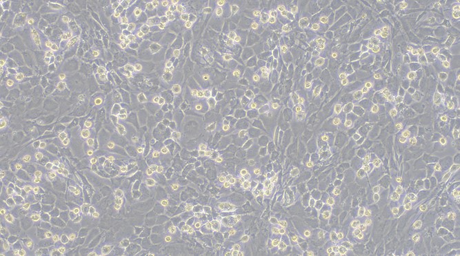 Primary Mouse Costochondral Chondrocytes (CC)