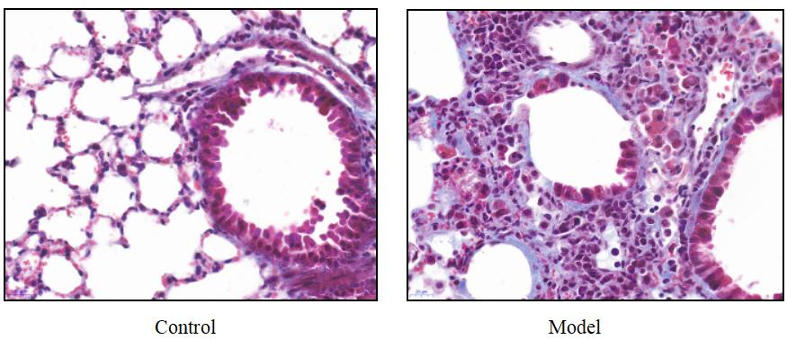 Mouse Model for Pulmonary Fibrosis (PF)