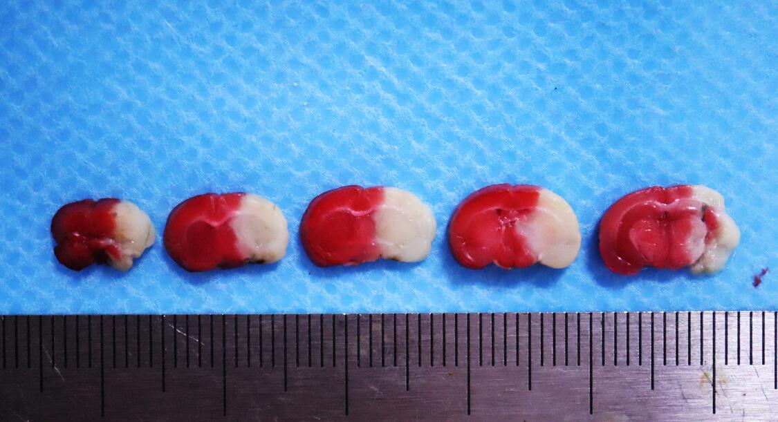 Mouse Model for Cerebral Ischemia (CI)