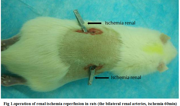 Rat Model for Renal Ischemia-Reperfusion Injury (RIRI)
