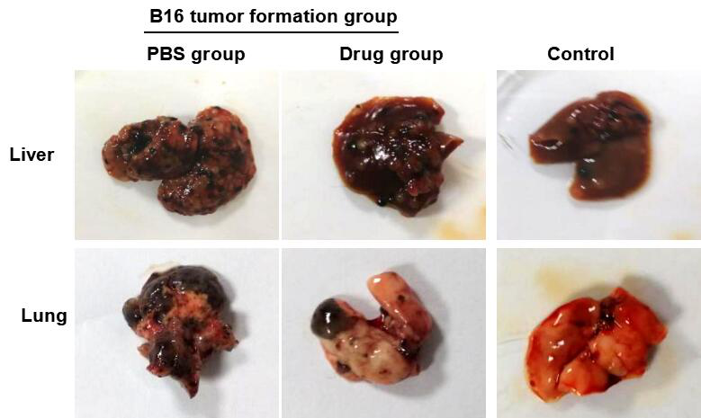 Mouse Model for Tumor Transplantation (TT)