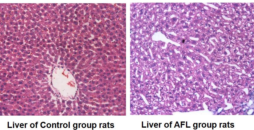 Rat Model for Alcoholic Hepatitis (AH)