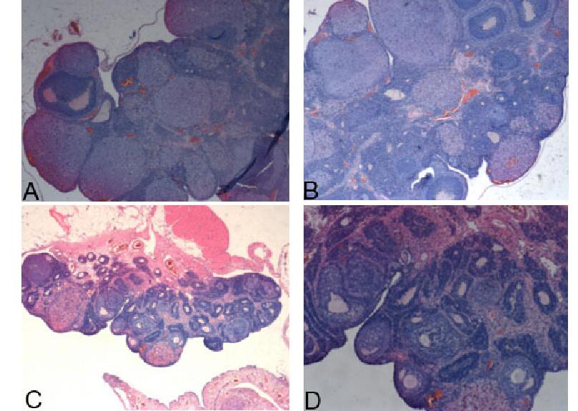 Rat Model for Polycystic Ovarian Syndrome (PCOS)