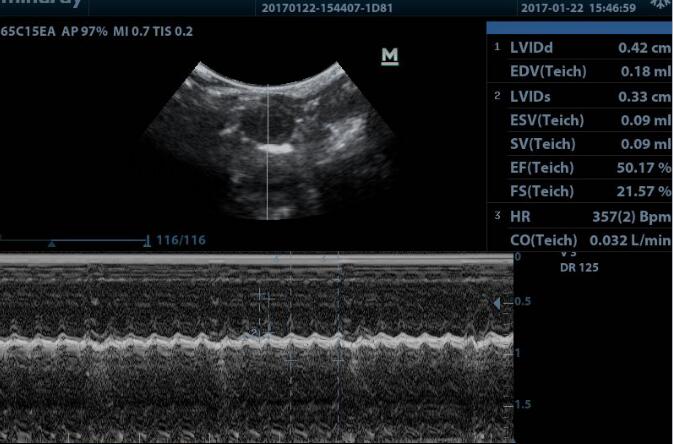 Mouse Model for Cardiac Hypertrophy (CH)