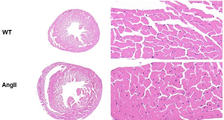 Mouse Model for Cardiac Hypertrophy (CH)