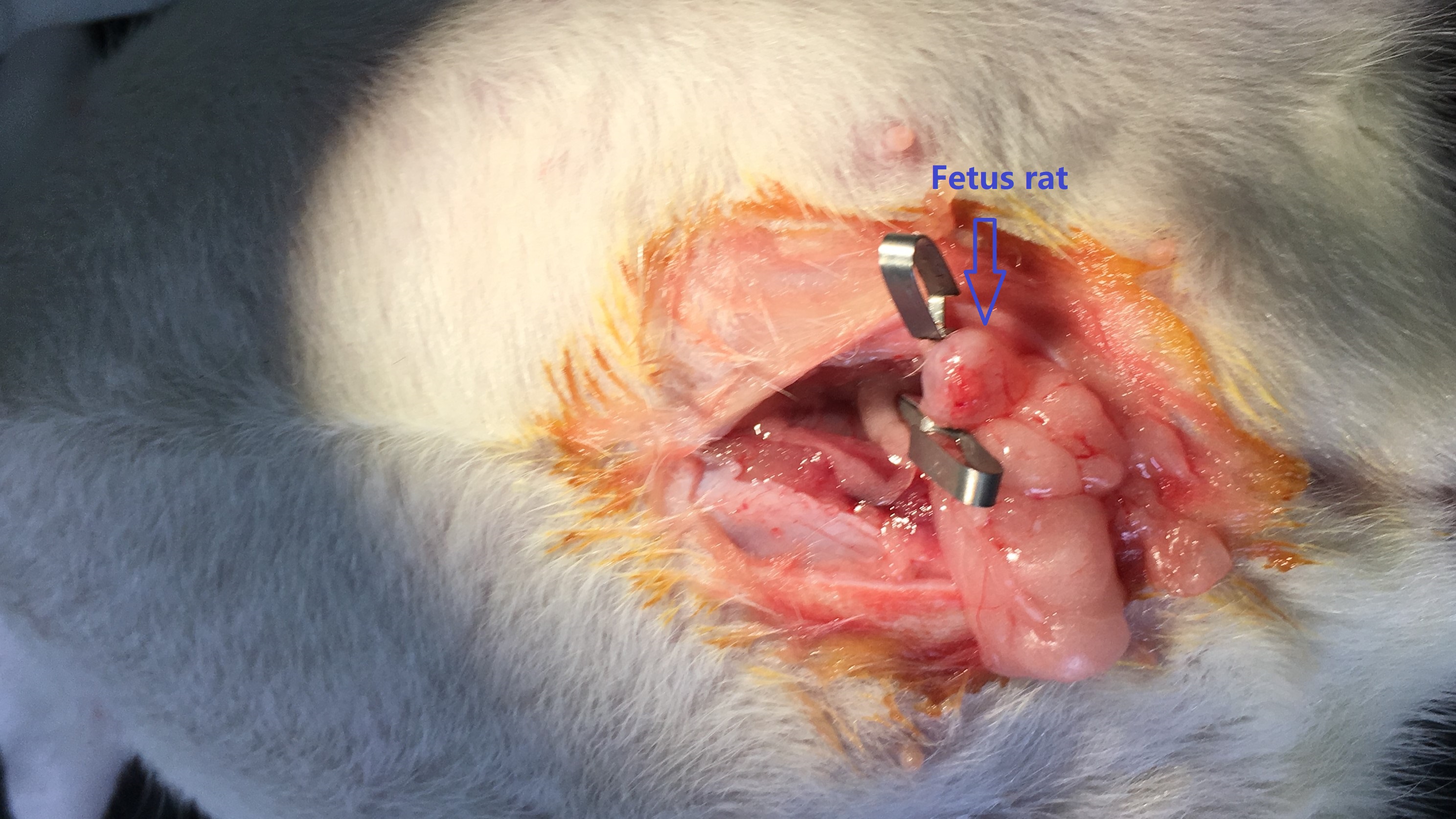 Rat Model for Intrahepatic Cholestasis of Pregnancy (ICP)