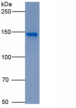 Eukaryotic Angiotensin I Converting Enzyme (ACE)