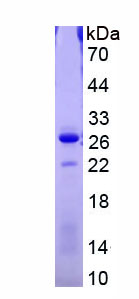 Eukaryotic Factor Related Apoptosis (FAS)