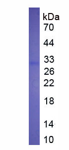 Eukaryotic Factor Related Apoptosis Ligand (FASL)