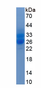 Eukaryotic FMS Like Tyrosine Kinase 3 Ligand (Flt3L)