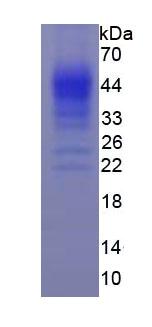 Eukaryotic Interferon Gamma (IFNg)