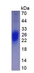 Eukaryotic Interferon Gamma (IFNg)