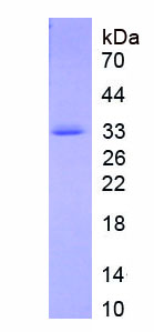 Eukaryotic Insulin Like Growth Factor Binding Protein 1 (IGFBP1)