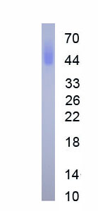 Eukaryotic Insulin Like Growth Factor Binding Protein 3 (IGFBP3)