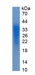 Eukaryotic Insulin Like Growth Factor Binding Protein 3 (IGFBP3)