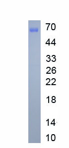 Eukaryotic Interleukin 13 (IL13)